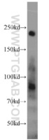 Anti-KRAP, SSFA2 Rabbit Polyclonal Antibody