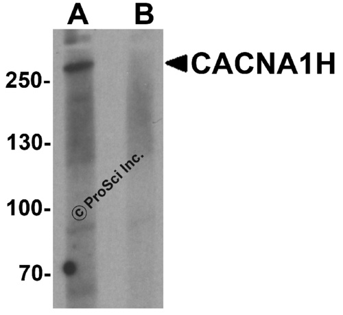 CACNA1H antibody