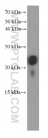 Anti-transgelin/SM22 Mouse Monoclonal Antibody [clone: 2A10C2]
