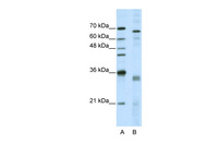 Anti-SRSF1 Rabbit Polyclonal Antibody