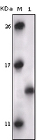 Anti-MAPKAPK5 Mouse Monoclonal Antibody [clone: 7H10B4]