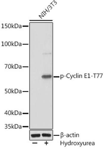 Anti-Cyclin E1 (phospho Thr77) Rabbit Antibody [CLone: ARC1559]