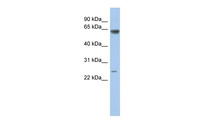 Anti-TAF5L Rabbit Polyclonal Antibody