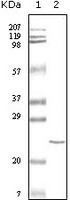 Anti-Troponin I Type 3 Mouse Monoclonal Antibody [clone: 3A10A12]