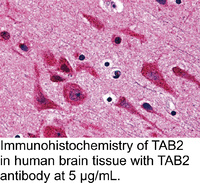 Anti-TAB2 Rabbit Polyclonal Antibody