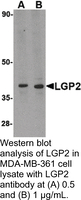 Anti-LGP2 Rabbit Polyclonal Antibody