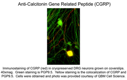 Calcitonin Gene Related Peptide (CGRP) Antibody