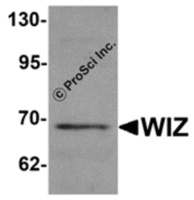 Anti-WIZ Rabbit Polyclonal Antibody
