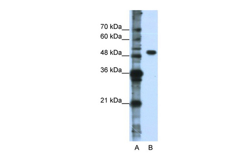 DDX47 antibody