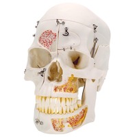 3B Scientific® Deluxe Dental Demonstration Skull