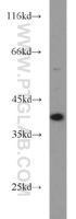 Anti-DNA polymerase beta Rabbit Polyclonal Antibody