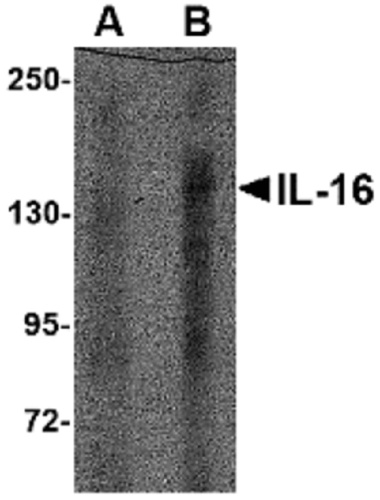 IL-16 antibody