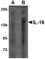 Anti-IL16 Rabbit Polyclonal Antibody