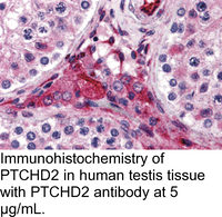 Anti-PTCHD2 Rabbit Polyclonal Antibody