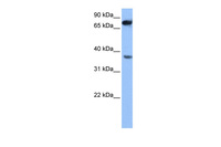 Anti-ZCCHC12 Rabbit Polyclonal Antibody