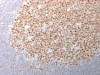 Anti-Bcl-6 Mouse Monoclonal Antibody [clone: BCL6/1982]