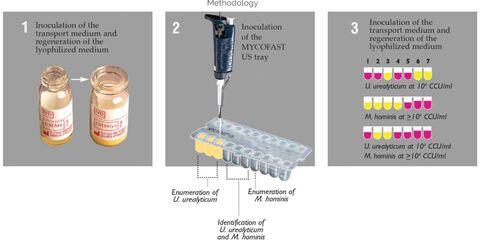 MYCOFAST® US Rapid Test for Ureaplasma Uyrealyticum and Mycoplasma Hominis, ELITech