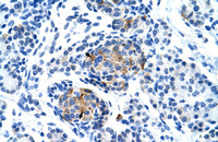 Anti-P2RX1 Rabbit Polyclonal Antibody
