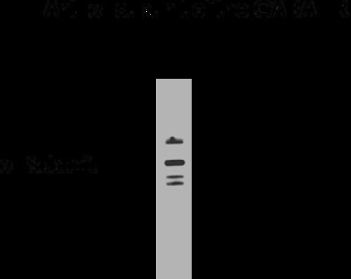 GABA A Receptor alpha 6 Antibody