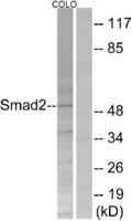 Anti-Smad2 + Smad3 Rabbit Polyclonal Antibody