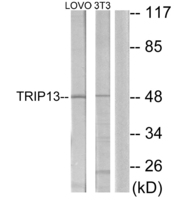 Anti-TRIP13 Rabbit Polyclonal Antibody