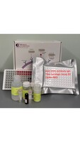 Human Anti-SARS Antibody IgG Titer Serologic Assay Kit (spike RBD)