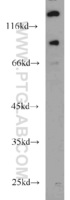 Anti-UNC5A Rabbit Polyclonal Antibody
