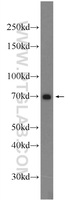 Anti-TRIM67 Rabbit Polyclonal Antibody