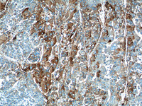 Anti-HABP2 Rabbit Polyclonal Antibody