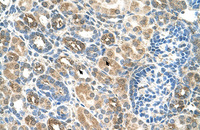 Anti-SLC22A16 Rabbit Polyclonal Antibody