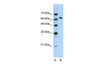 Anti-SUPT16H Rabbit Polyclonal Antibody