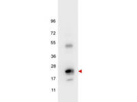 Anti-IL6 Rabbit Polyclonal Antibody