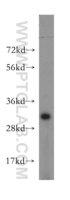 Anti-ATP6V1E2 Rabbit Polyclonal Antibody