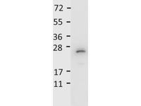 Anti-IL27 Rabbit Polyclonal Antibody (HRP (Horseradish Peroxidase))