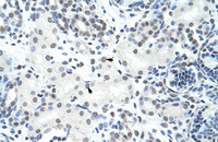 Anti-HNRNPH3 Rabbit Polyclonal Antibody