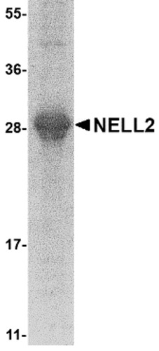 NELL2 Recombinant Protein, Species: Mouse, Host: E.coli