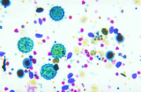 Mixed Pollen, 16 Types Slide