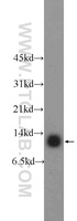 Anti-CDC26 Rabbit Polyclonal Antibody