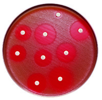 BD BBL™ Sensi-Disc™ Antimicrobial Susceptibility Test Discs, BD Diagnostics