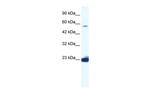 DDX55 Antibody