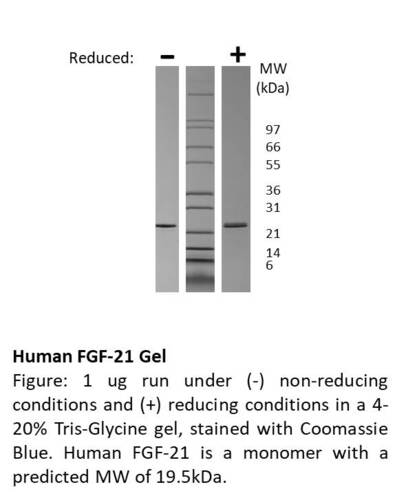 Human Recombinant FGF-21 (from <i>E. coli</i>)