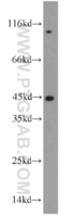 Anti-ST8 Alpha-N-Acetyl-Neuraminide Alpha-2,8-Sialyltransferase 3 Rabbit Polyclonal Antibody