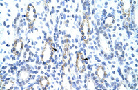 Anti-GTF2IRD1 Rabbit Polyclonal Antibody