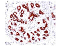 Anti-BAX Rabbit Monoclonal Antibody [clone: SP47]