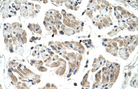Anti-CHST1 Rabbit Polyclonal Antibody