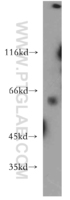 Anti-CYP26B1 Rabbit Polyclonal Antibody