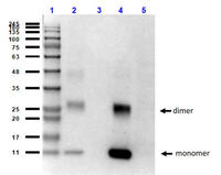 Anti-HbB Mouse Monoclonal Antibody [Clone: 14G2.G11.F11]