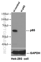 Anti-p65; RELA Rabbit Polyclonal Antibody