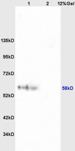RPS6KB1(Ser427) Antibody