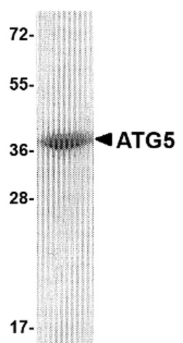ATG5 Recombinant Protein